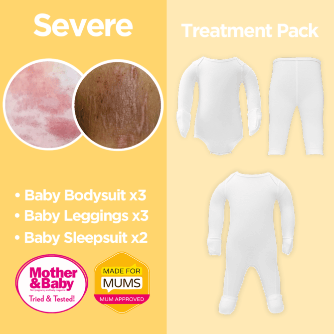 Severe Eczema Baby Pack