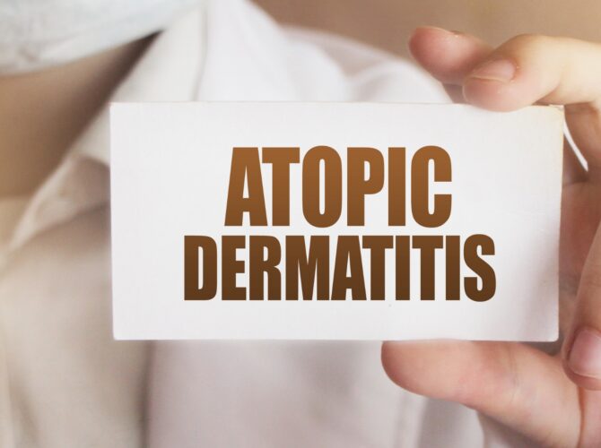 Relief from Atopic Dermatitis