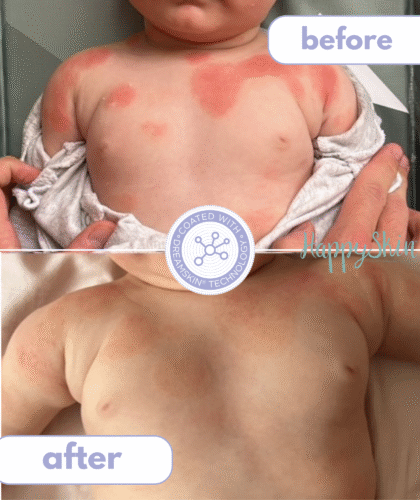 happyskin review picture