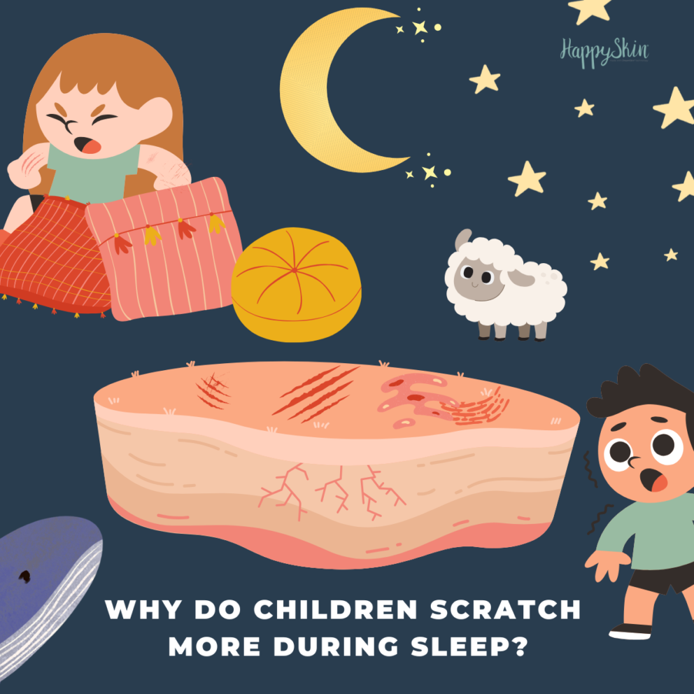 Why do children scratch more during sleep?