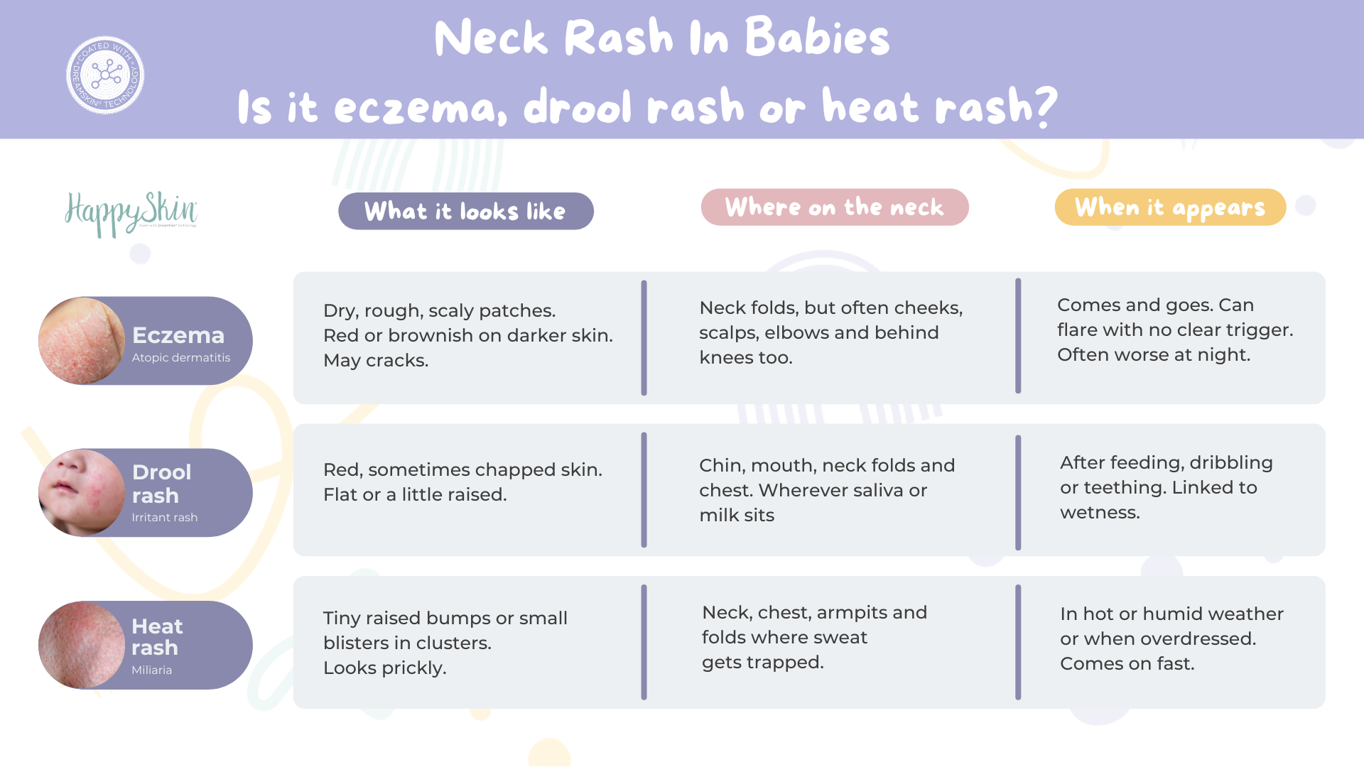 what tends to helps rashes in babies?