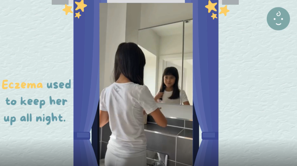 Eczema keeps girls itching and scratching