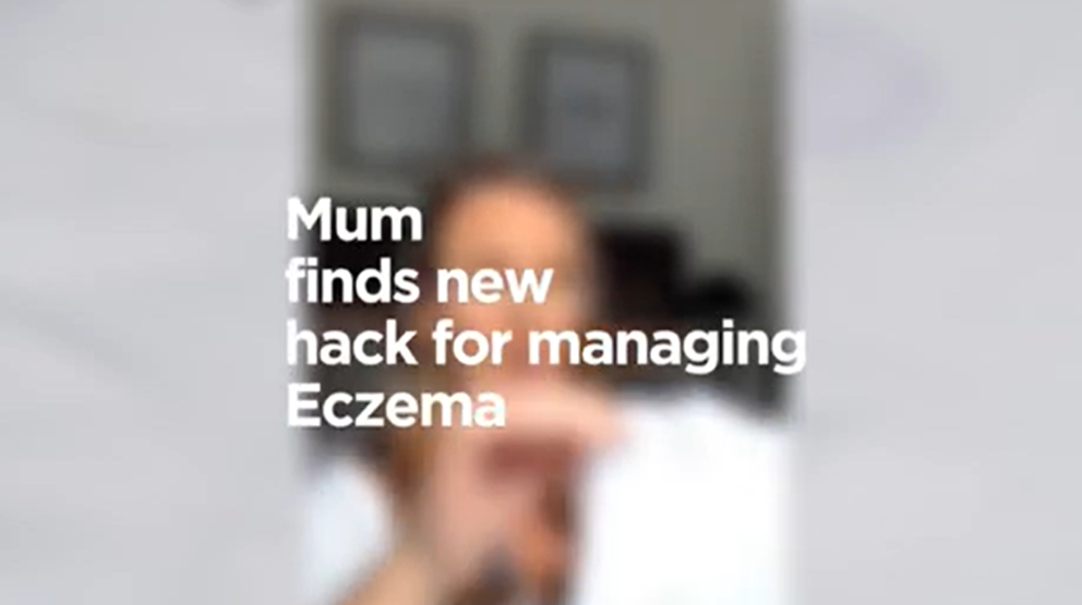 mum finds new hack for managing eczema
