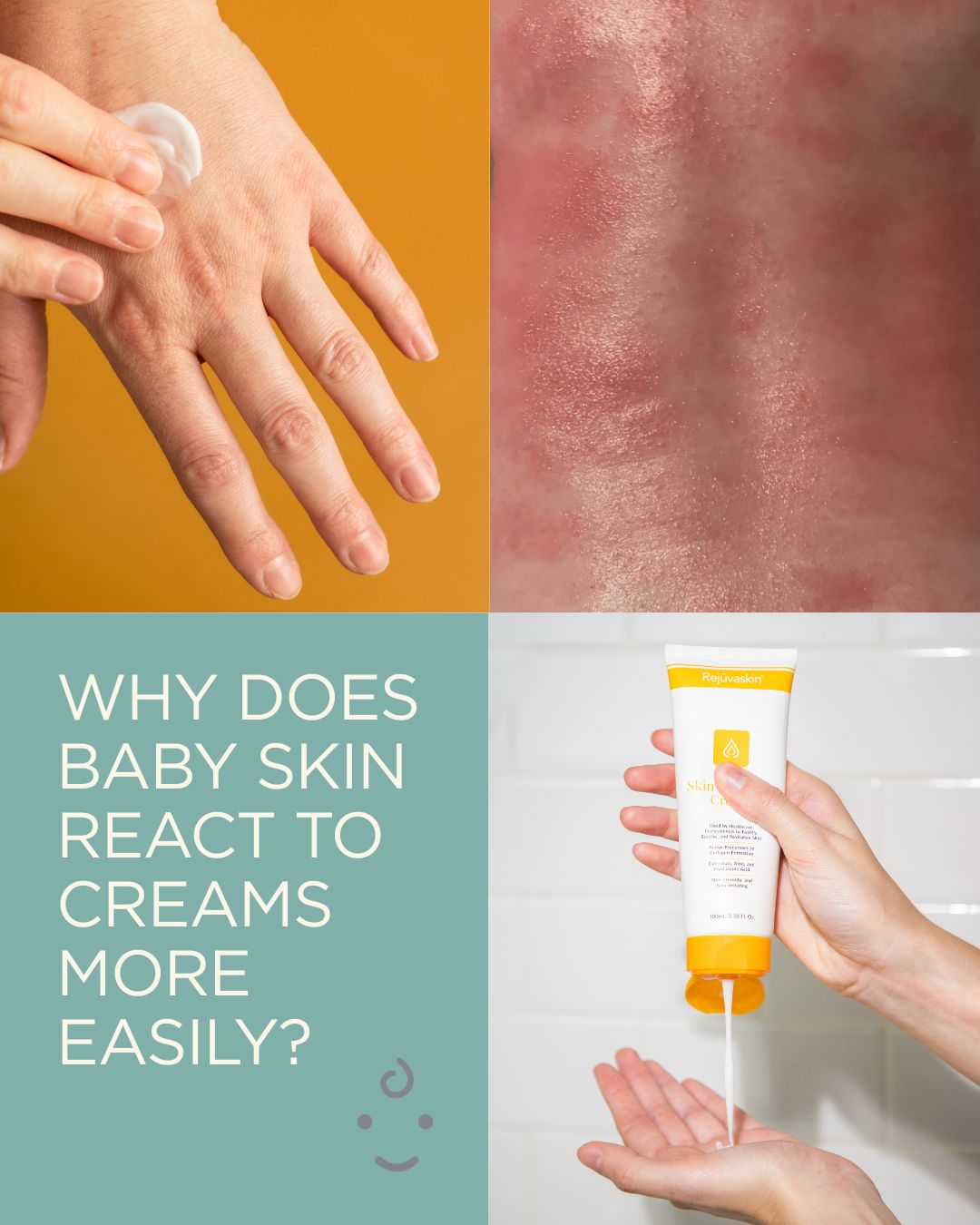 illustrated why does baby skin reacts cream-based better